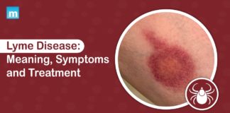Lyme Disease: Meaning, Symptoms and Treatment