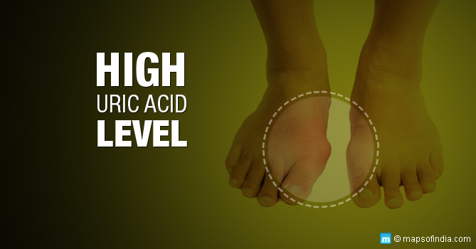 High Uric Acid Levels - Causes, Symptoms & Prevention