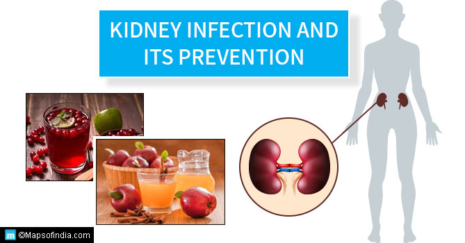 Prevention Of Kidney Infections