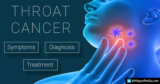 Throat Cancer Symptoms