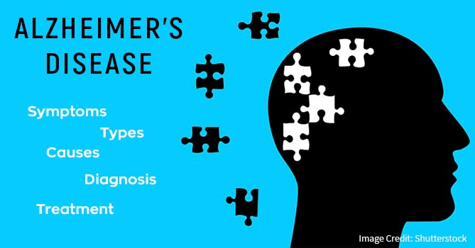 Alzheimer's Disease - Most Common Type of Dementia