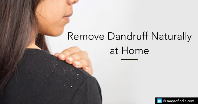 How to remove dandruff naturally at home