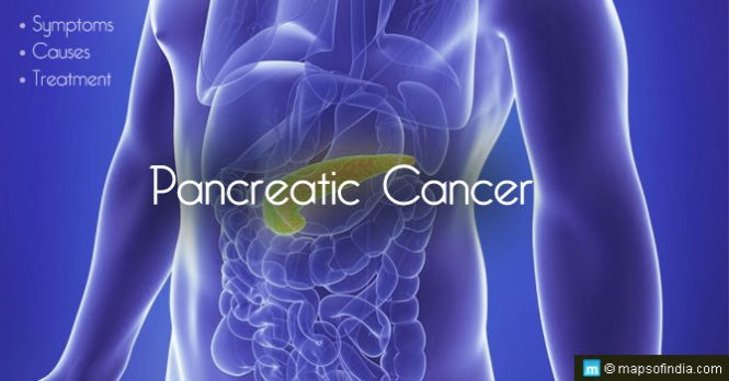 Pancreatic Cancer - Symptoms, Causes and Treatment - India