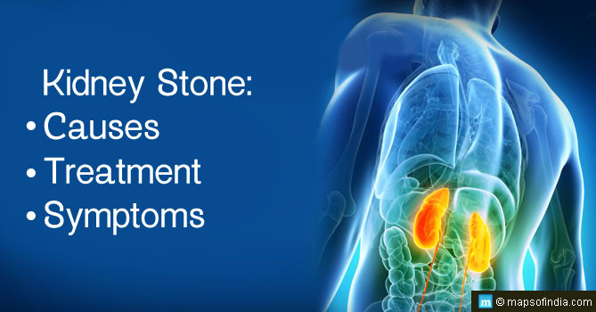 Kidney Stone Causes Symptoms And Treatment India