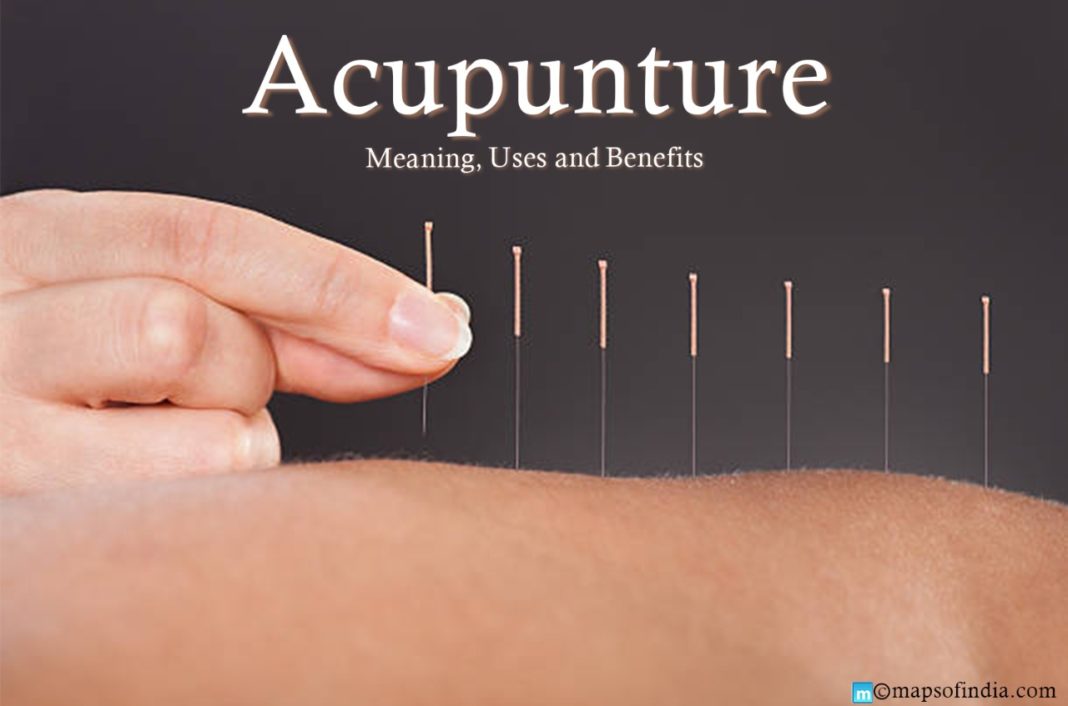 Acupuncture Meaning, Uses and Benefits Education Blogs
