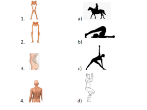 Match the postural deformities with their remedial activity
