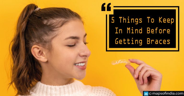 Five things to keep in mind before getting braces
