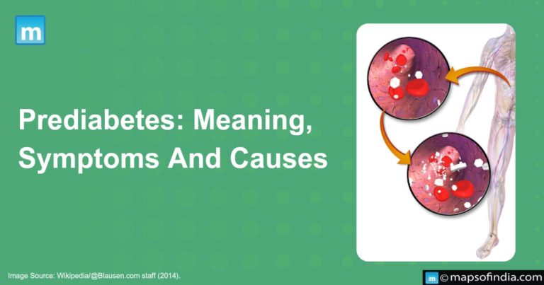 Prediabetes: Meaning, Symptoms & Causes