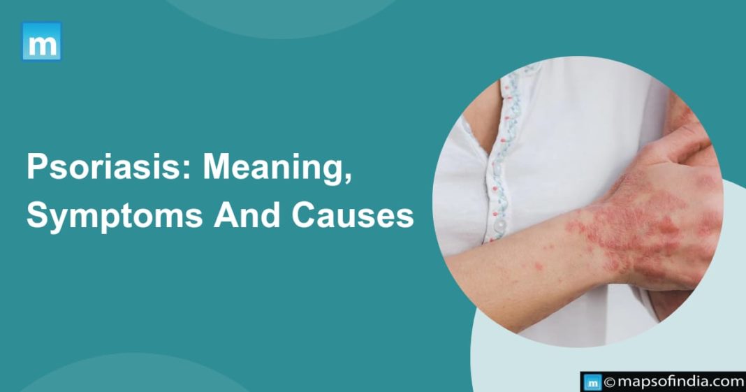 Psoriasis Meaning, Symptoms And Causes Health