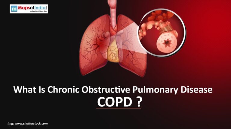 What Is Chronic Obstructive Pulmonary Disease (COPD)? What Is Chronic Obstructive Pulmonary Disease (COPD)?