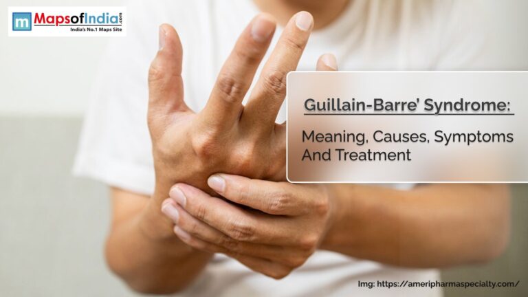 Guillain-Barré Syndrome: Meaning, Causes, Symptoms And Treatment